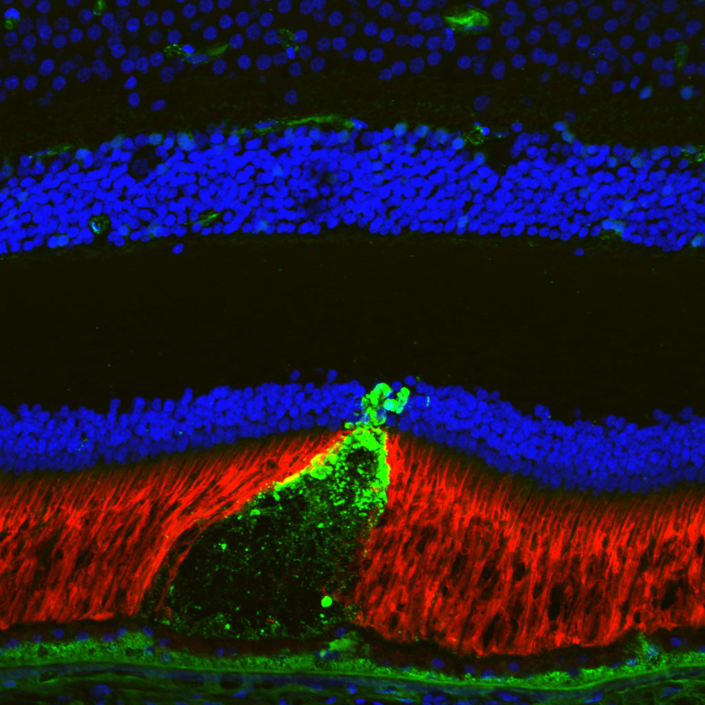 A visual showing layers within a retina, captured under a microscope